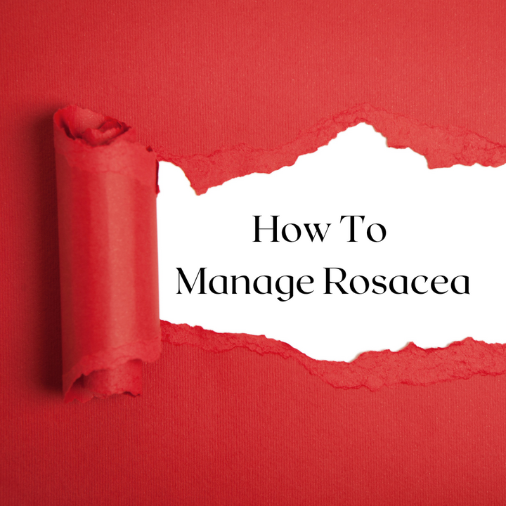 How To Manage Rosacea